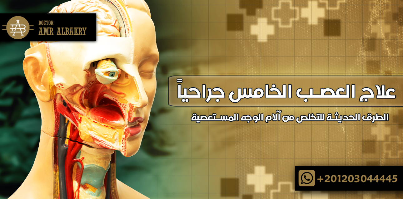 علاج العصب الخامس جراحياً