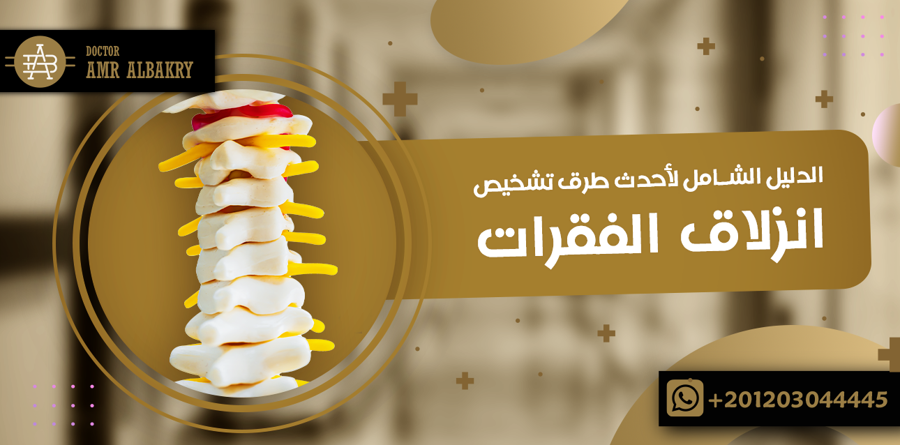 انزلاق الفقرات