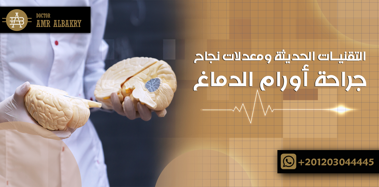 علاج أورام الدماغ بالجراحة