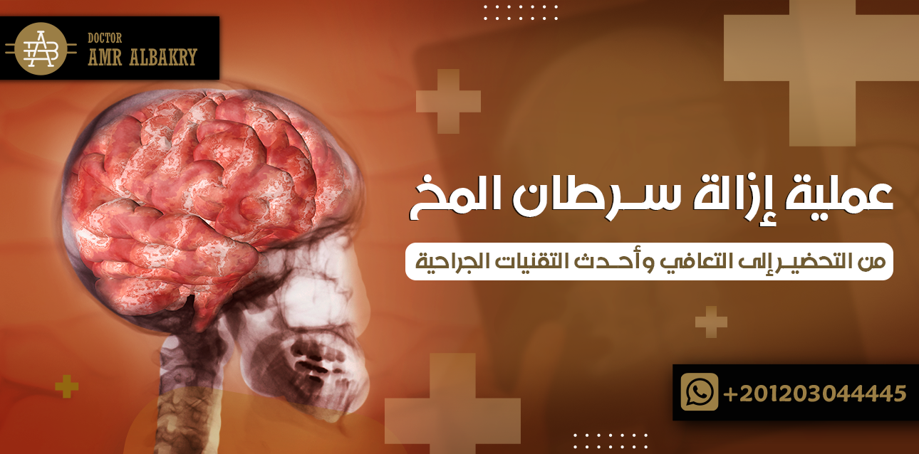 عملية إزالة سرطان المخ