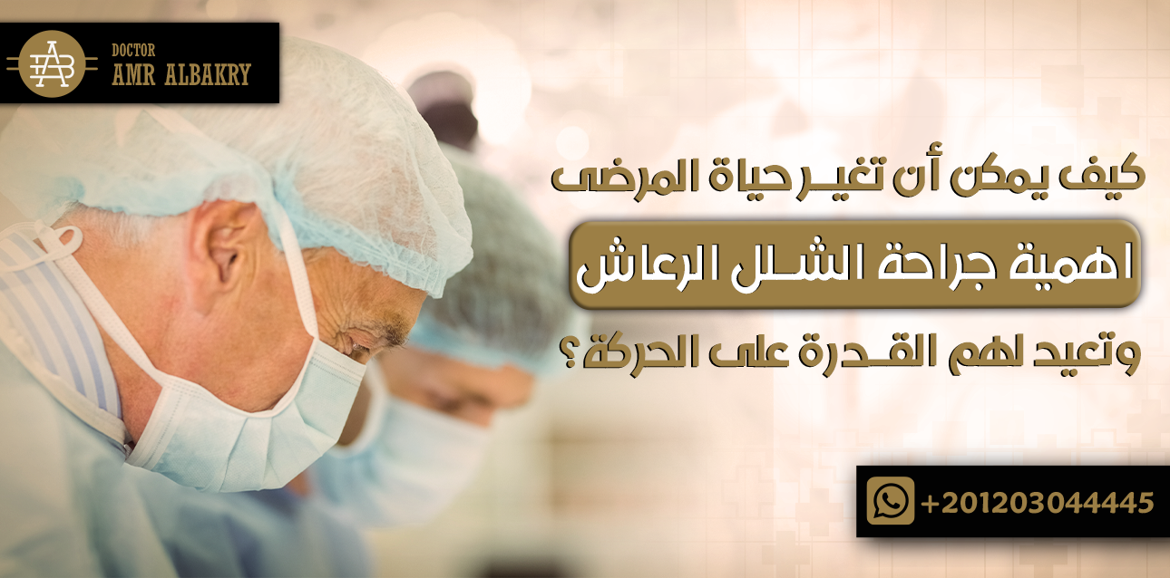 اهمية جراحة الشلل الرعاش