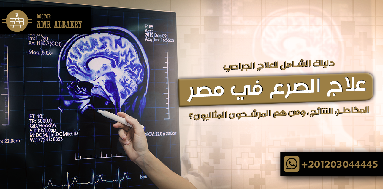 علاج الصرع فى مصر