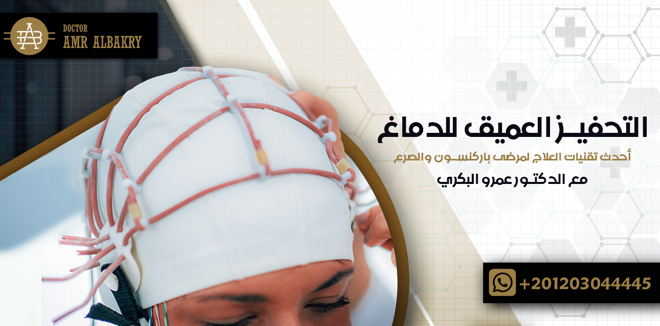 التحفيز العميق