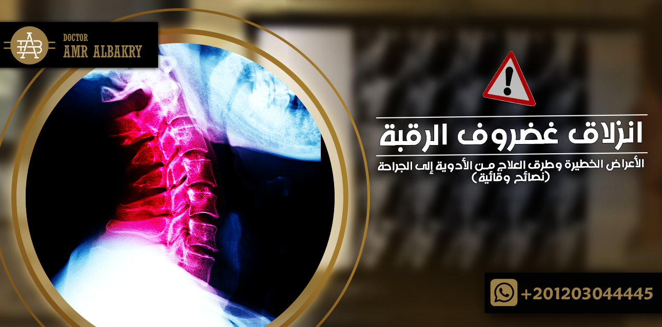انزلاق غضروف الرقبة
