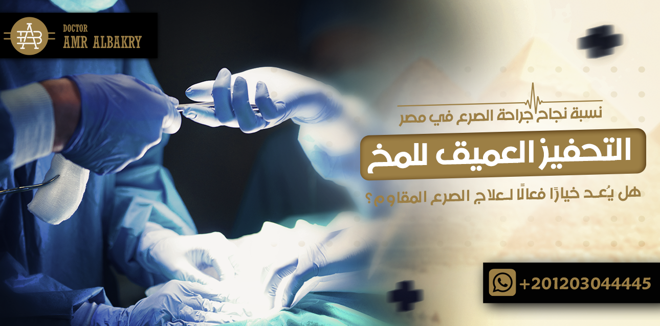 نسبة نجاح جراحة الصرع في مصر