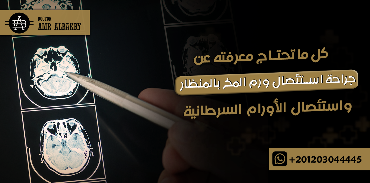 جراحة استئصال ورم المخ بالمنظار