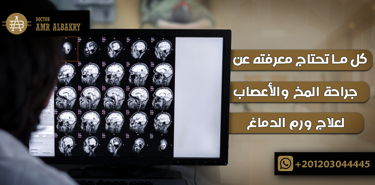 جراحة المخ والأعصاب