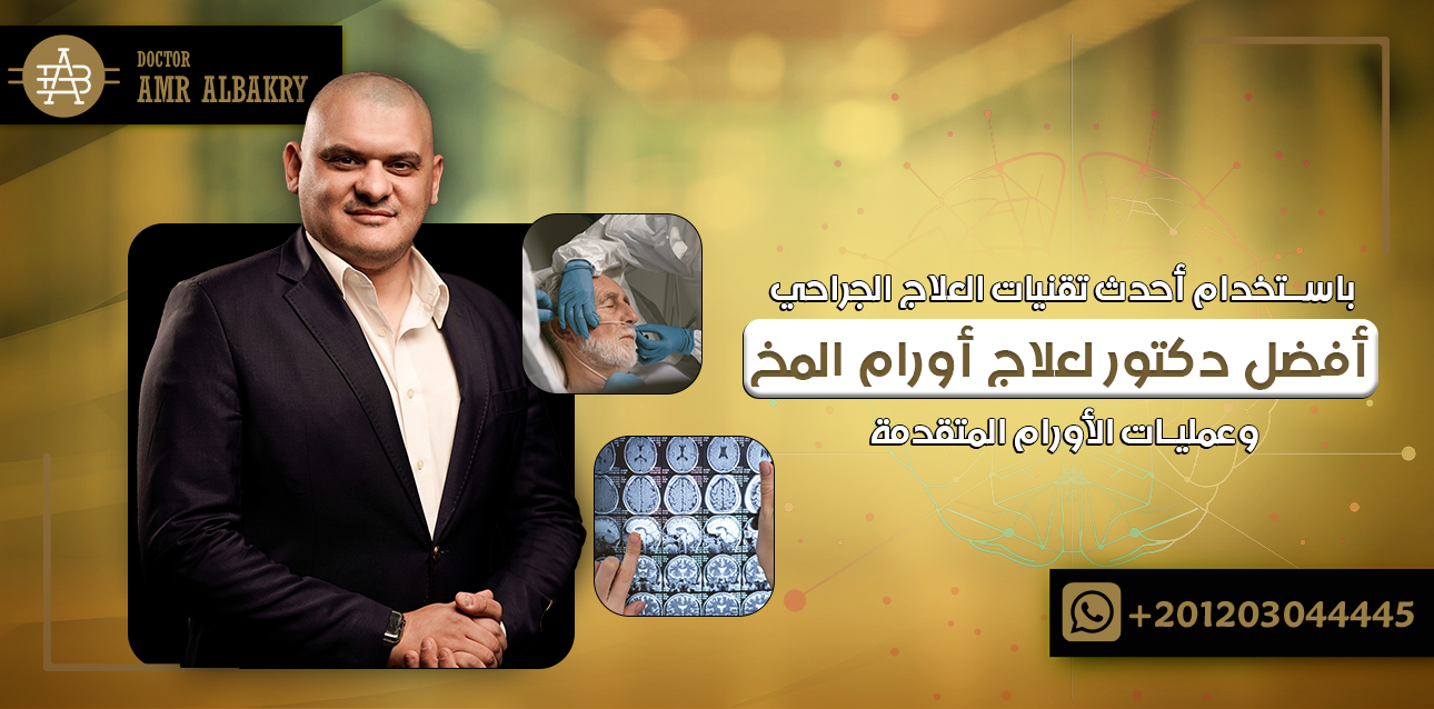 أفضل دكتور لعلاج أورام المخ