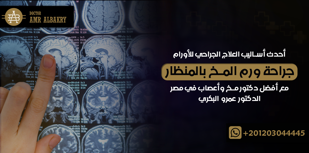 جراحة ورم المخ بالمنظار