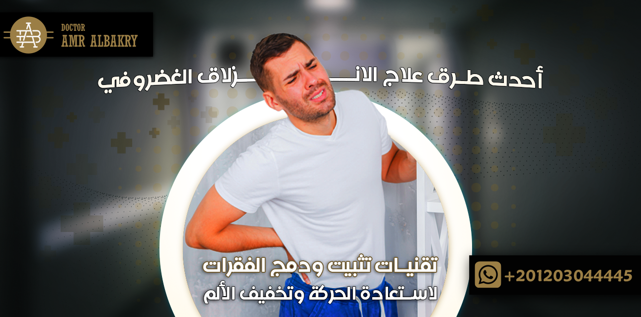 أحدث طرق علاج الانزلاق الغضروفي