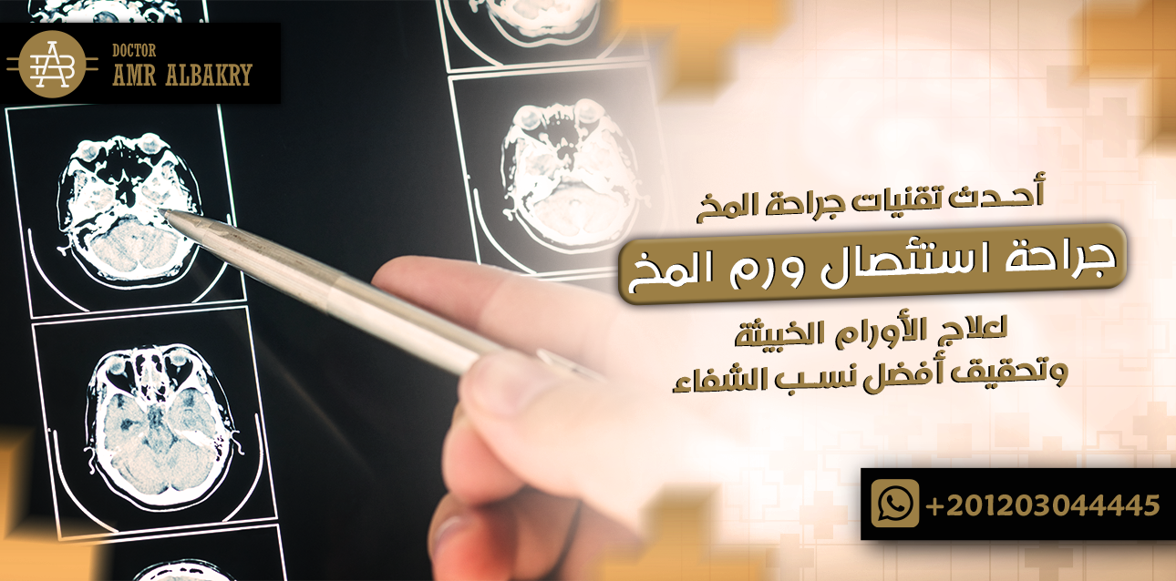 جراحة استئصال ورم المخ