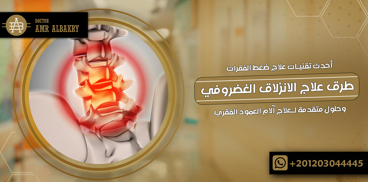 طرق علاج الانزلاق الغضروفي