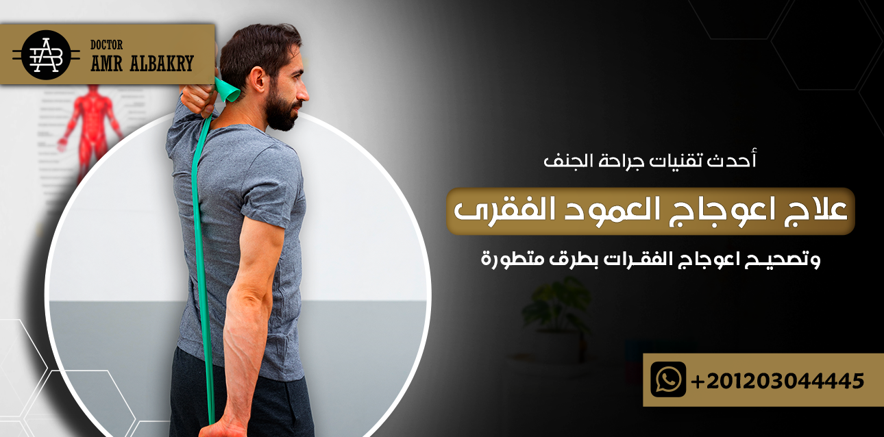 علاج اعوجاج العمود الفقرى