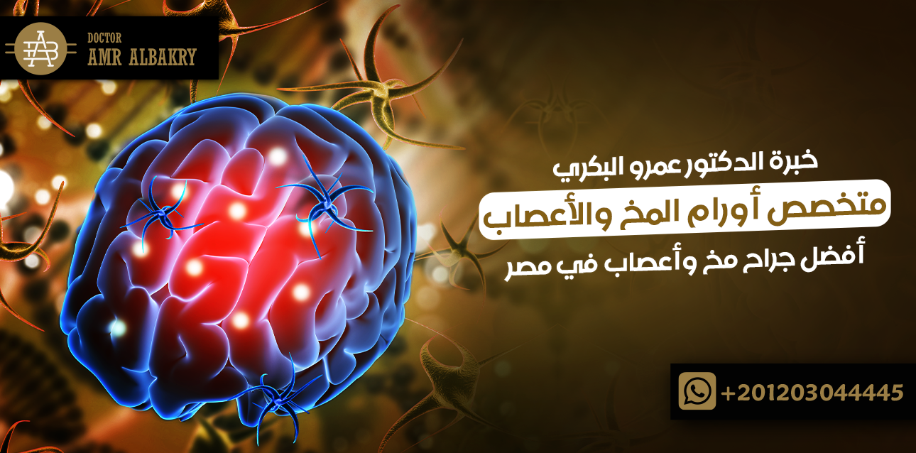 متخصص أورام المخ والأعصاب