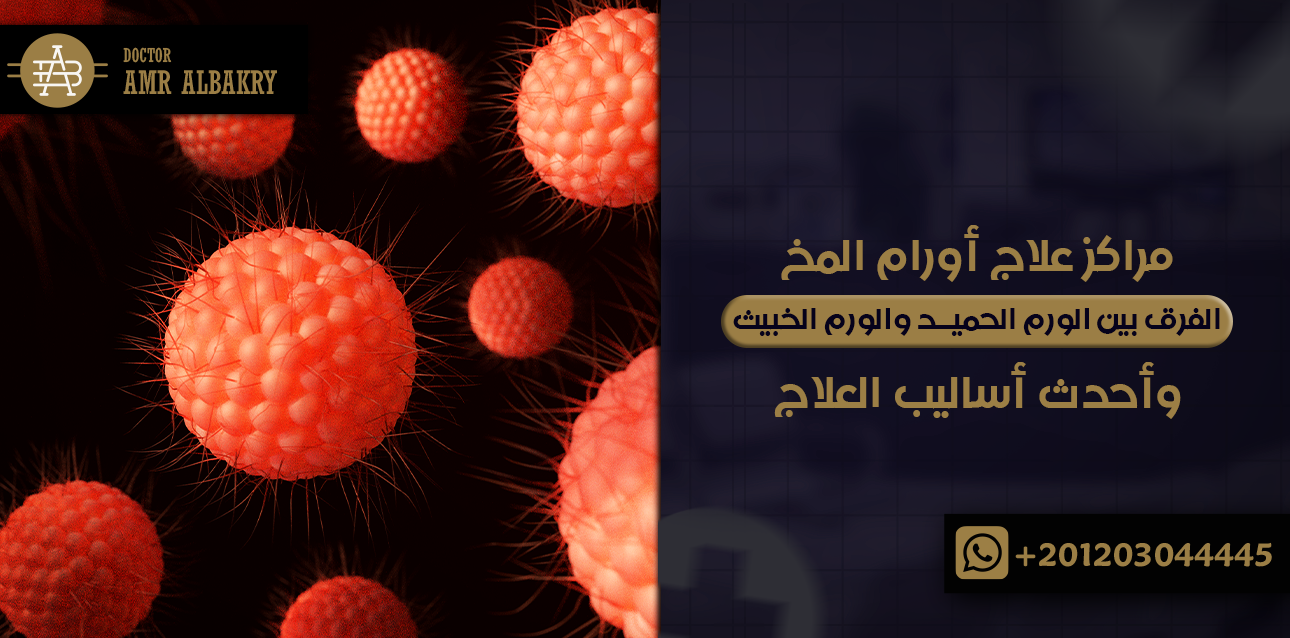 مراكز علاج أورام المخ