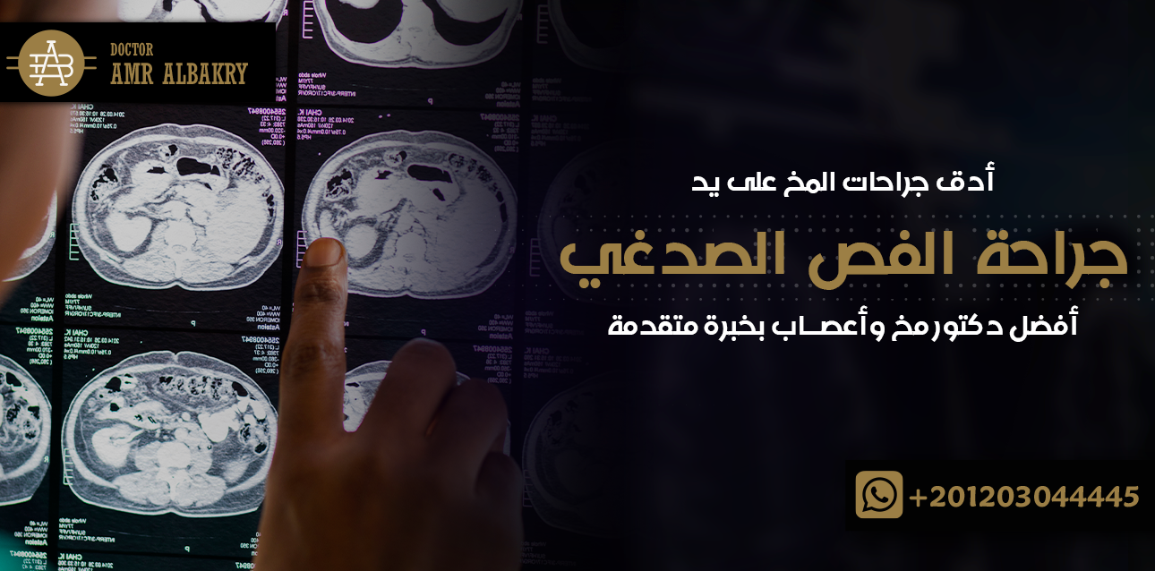 جراحة الفص الصدغي