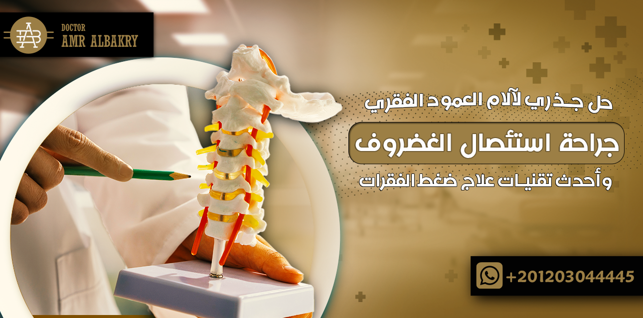 جراحة استئصال الغضروف