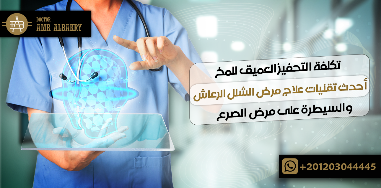 تكلفة التحفيز العميق للمخ