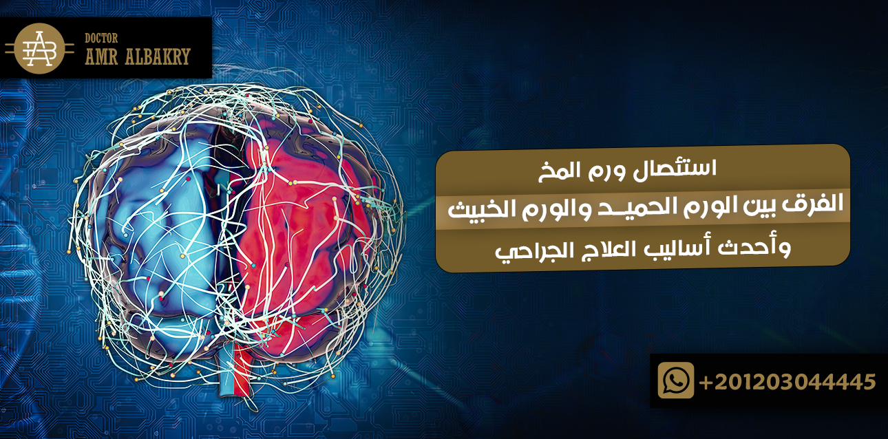 استئصال ورم المخ