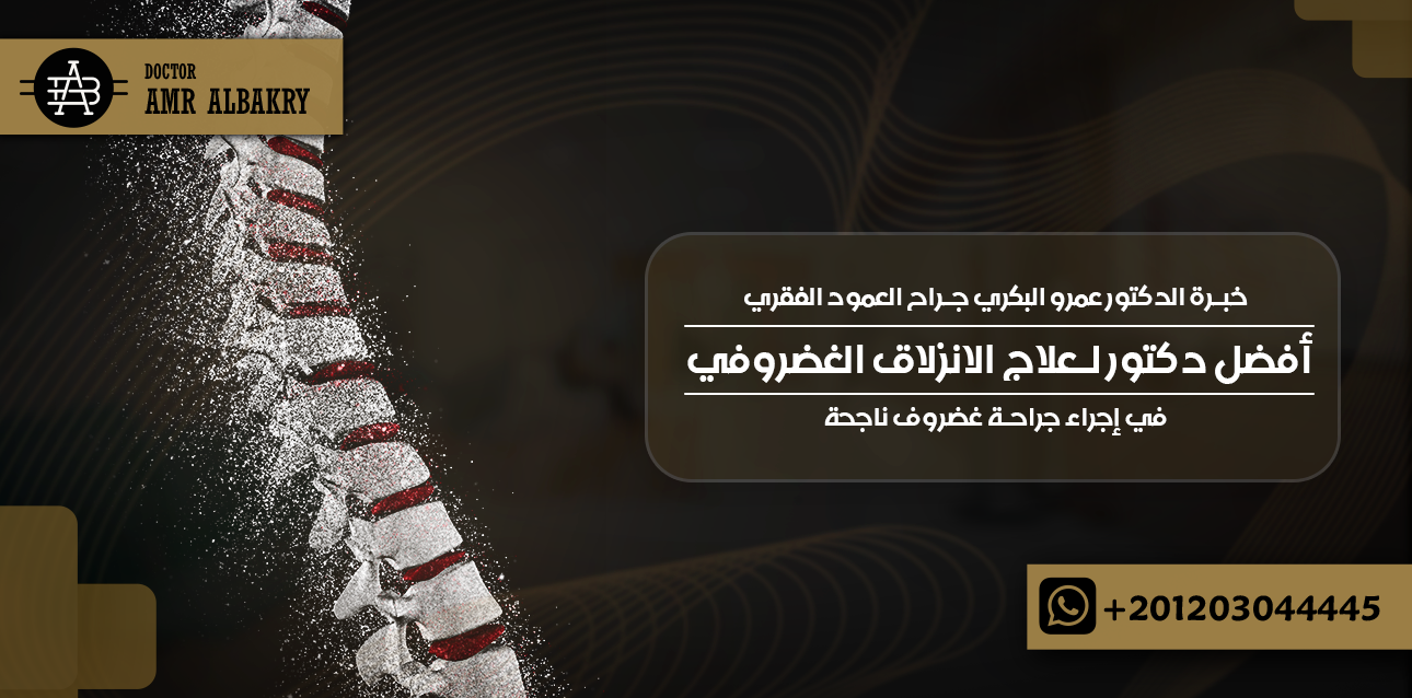 أفضل دكتور لعلاج الانزلاق الغضروفي