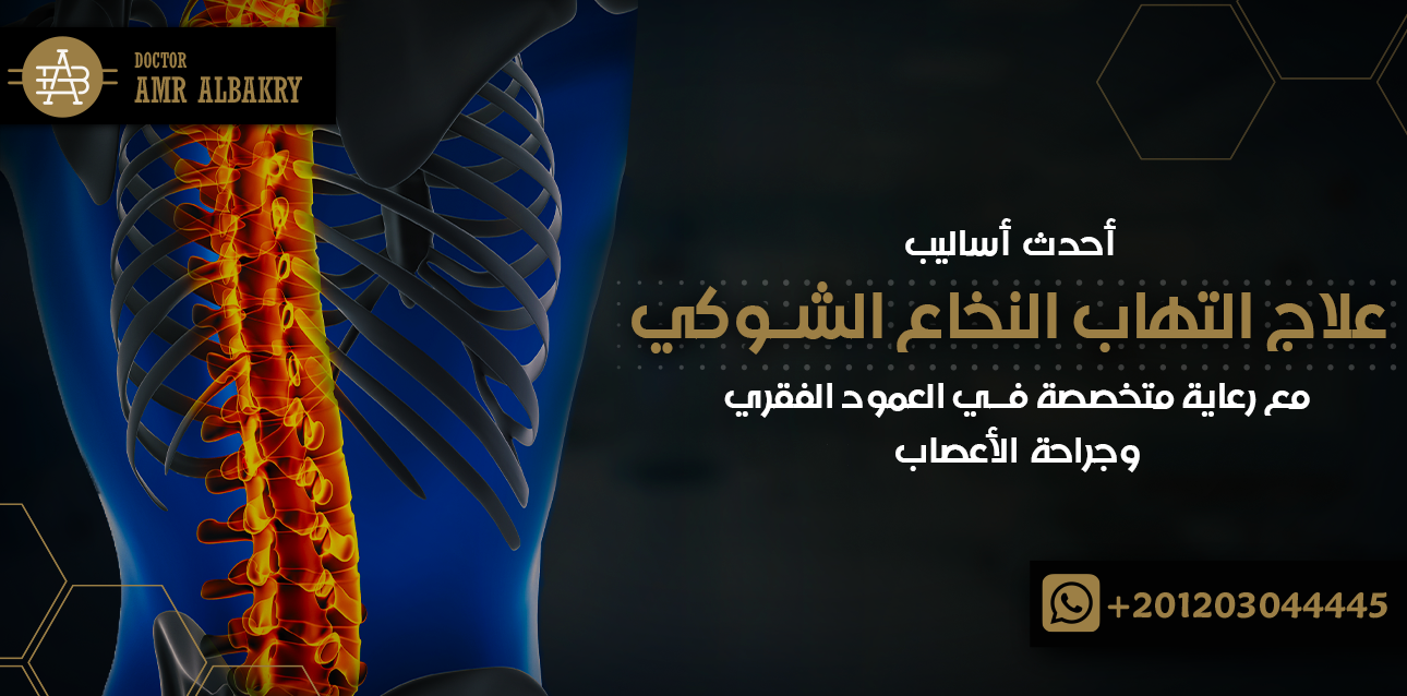 علاج التهاب النخاع الشوكي