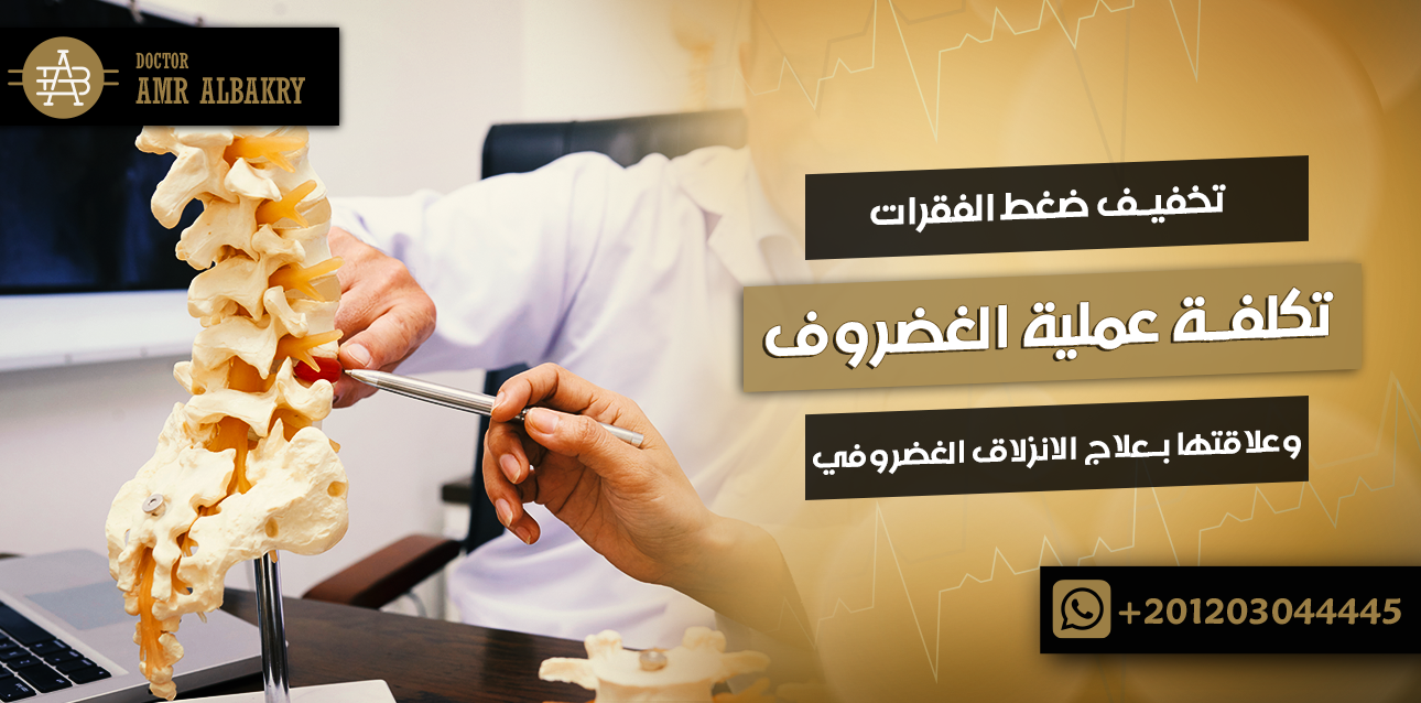 تكلفة عملية الغضروف