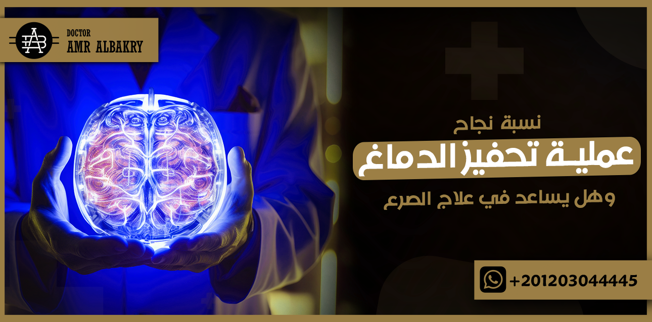 نسبة نجاح عملية تحفيز الدماغ في علاج الصرع