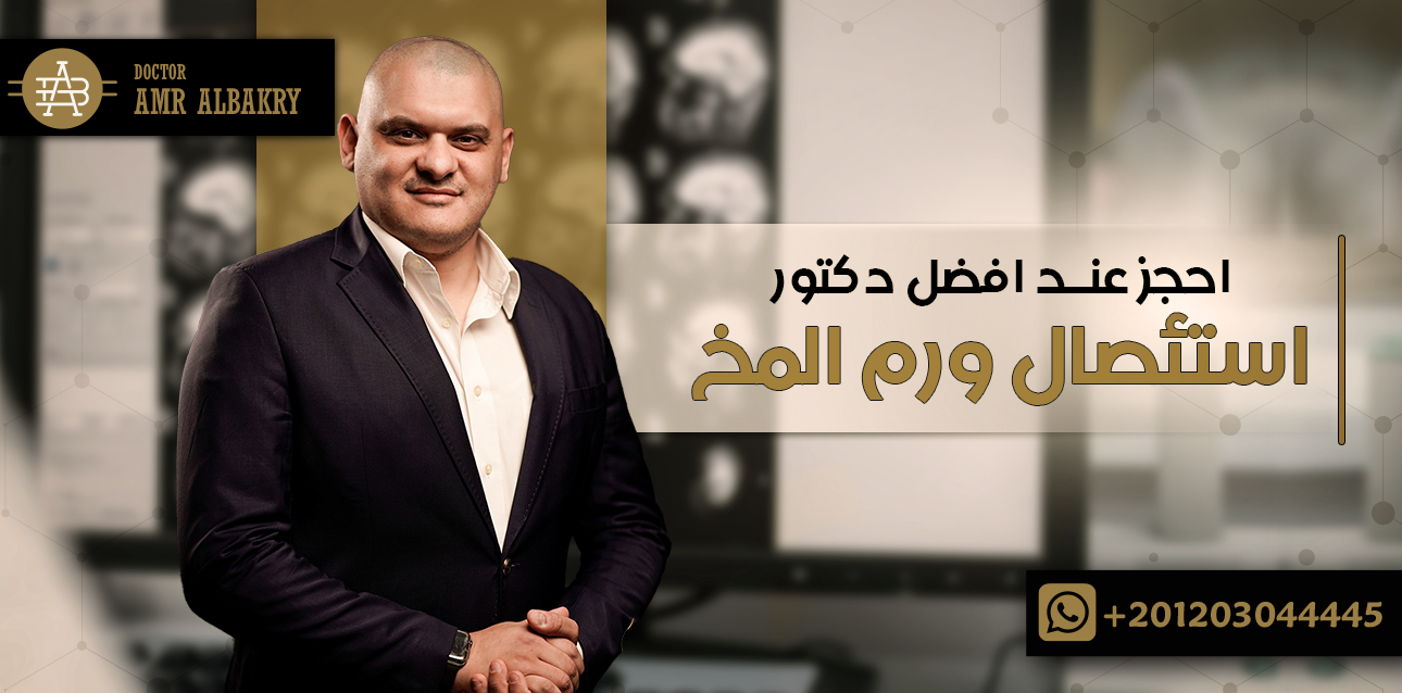 احجز عند افضل دكتور عملية استئصال ورم المخ - Dr Amr Albakry