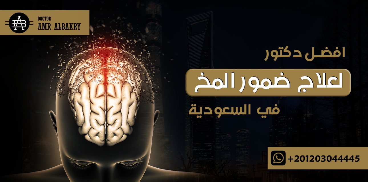 افضل دكتور لعلاج ضمور المخ في السعوديه