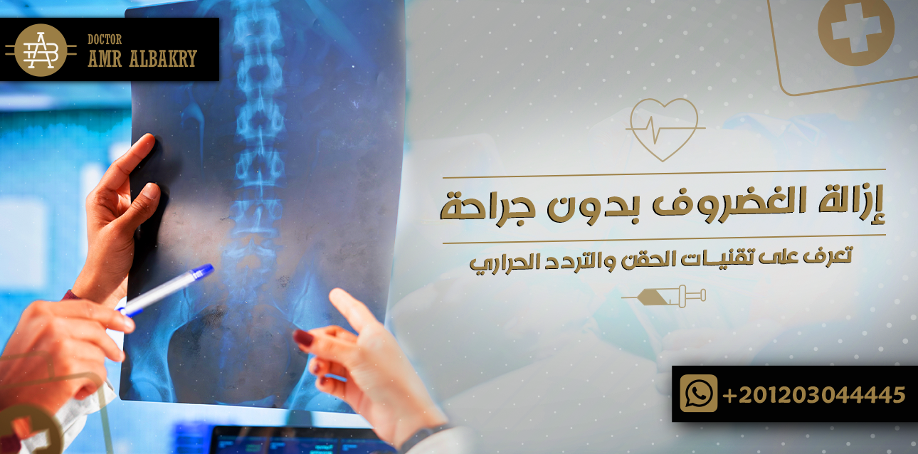 هل يمكن ازالة الغضروف بدون جراحة؟ تعرف على تقنيات الحقن والتردد الحراري