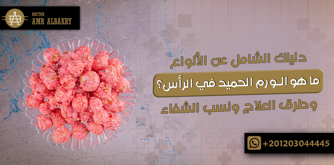 ما هو الورم الحميد في الراس؟ دليلك الشامل عن الأنواع وطرق العلاج ونسب الشفاء