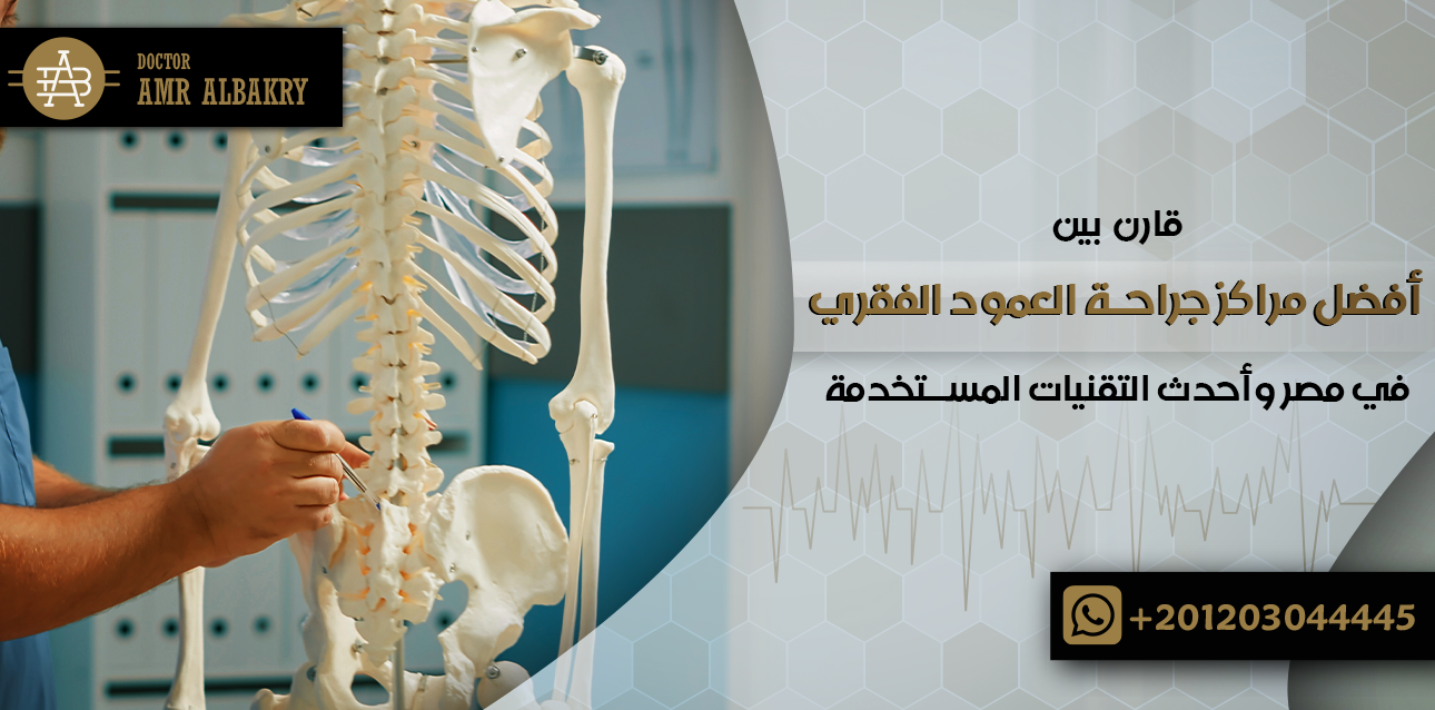 قارن بين أفضل مراكز جراحة العمود الفقري في مصر وأحدث التقنيات المستخدمة