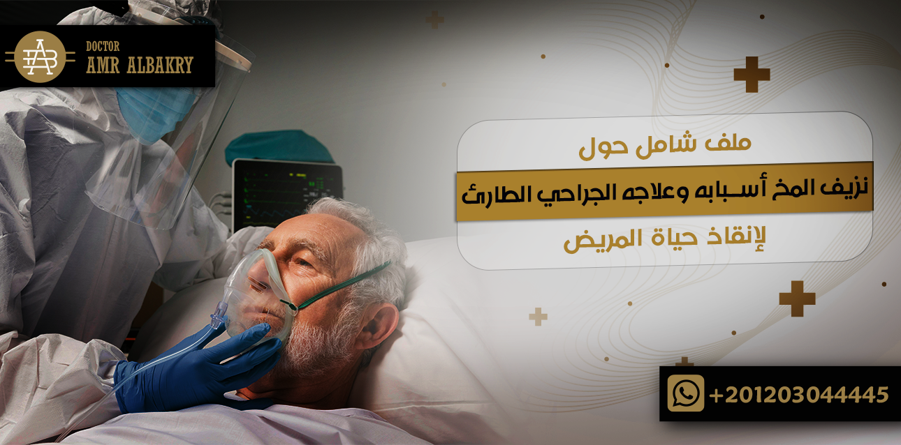 ملف شامل حول نزيف المخ أسبابه وعلاجه الجراحي الطارئ لإنقاذ حياة المريض