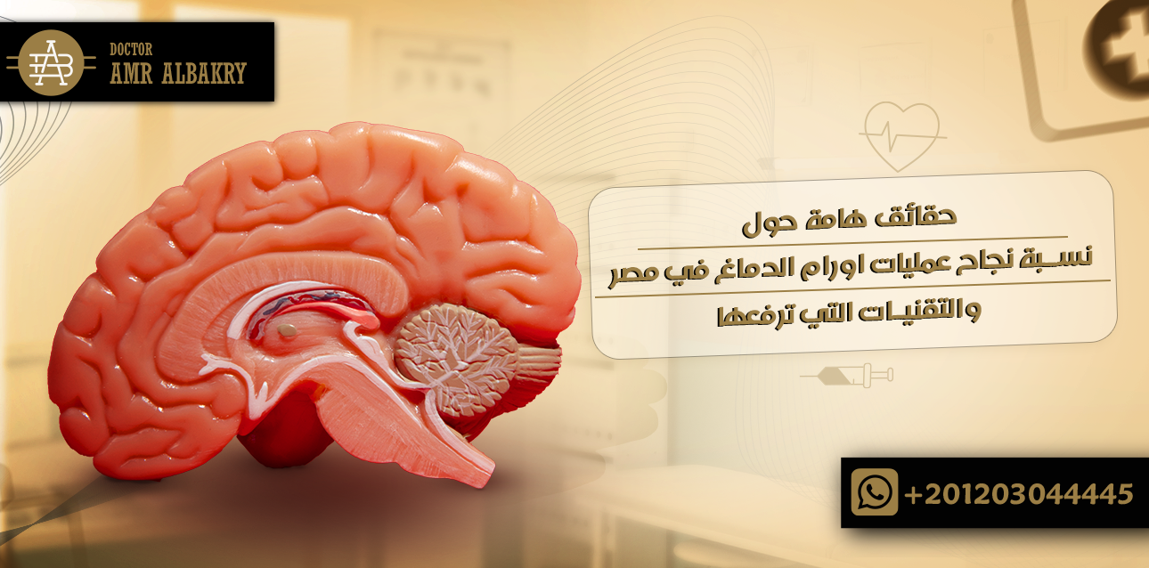 نسبة نجاح عمليات اورام الدماغ