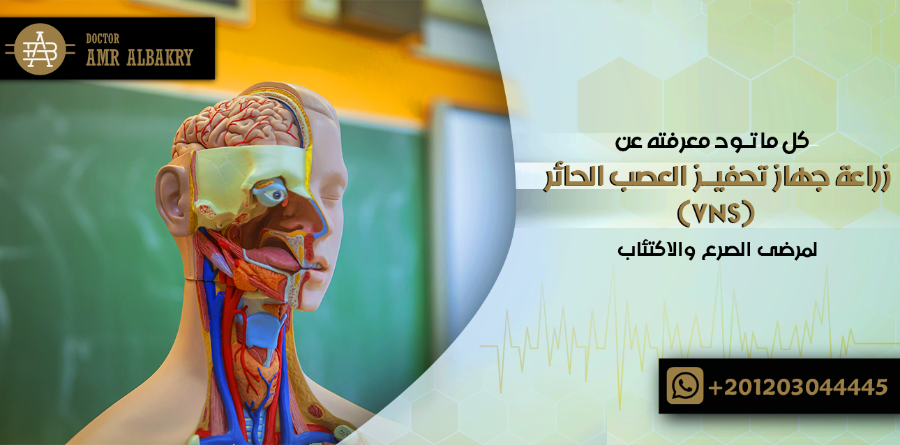 زراعة جهاز تحفيز العصب الحائر (VNS)