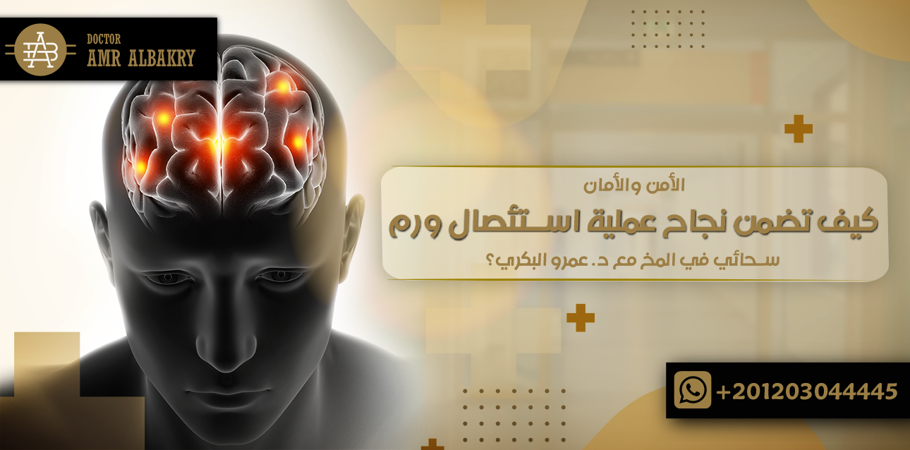 استئصال ورم سحائي في المخ