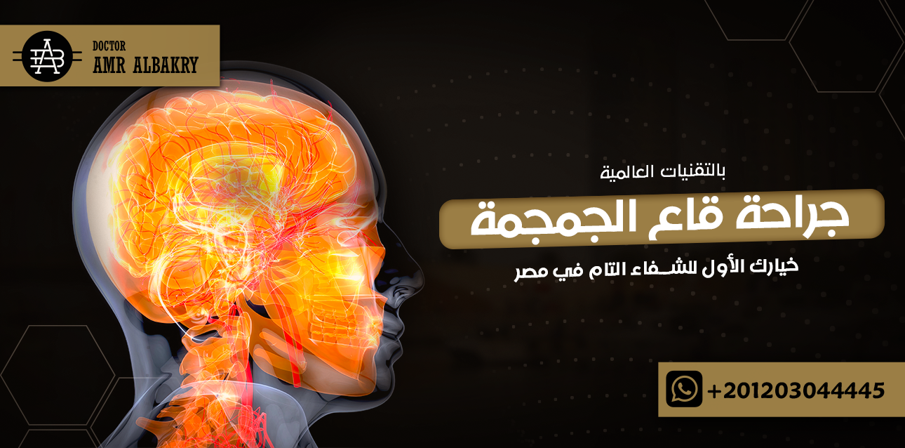 جراحة قاع الجمجمة بالتقنيات العالمية
