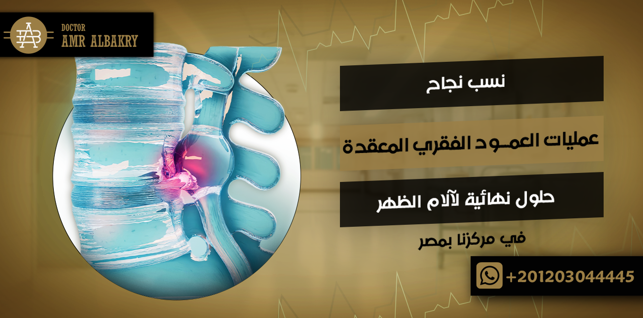 الرئيسية 21 عمليات العمود الفقري المعقدة