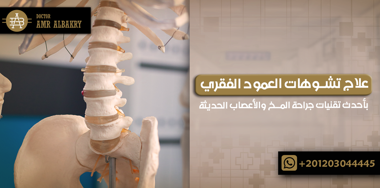 علاج تشوهات العمود الفقري