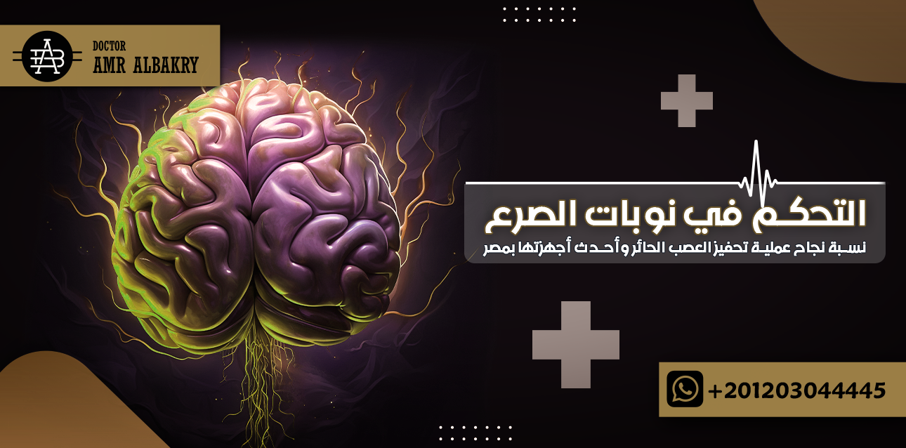 نسبة نجاح عملية تحفيز العصب الحائر
