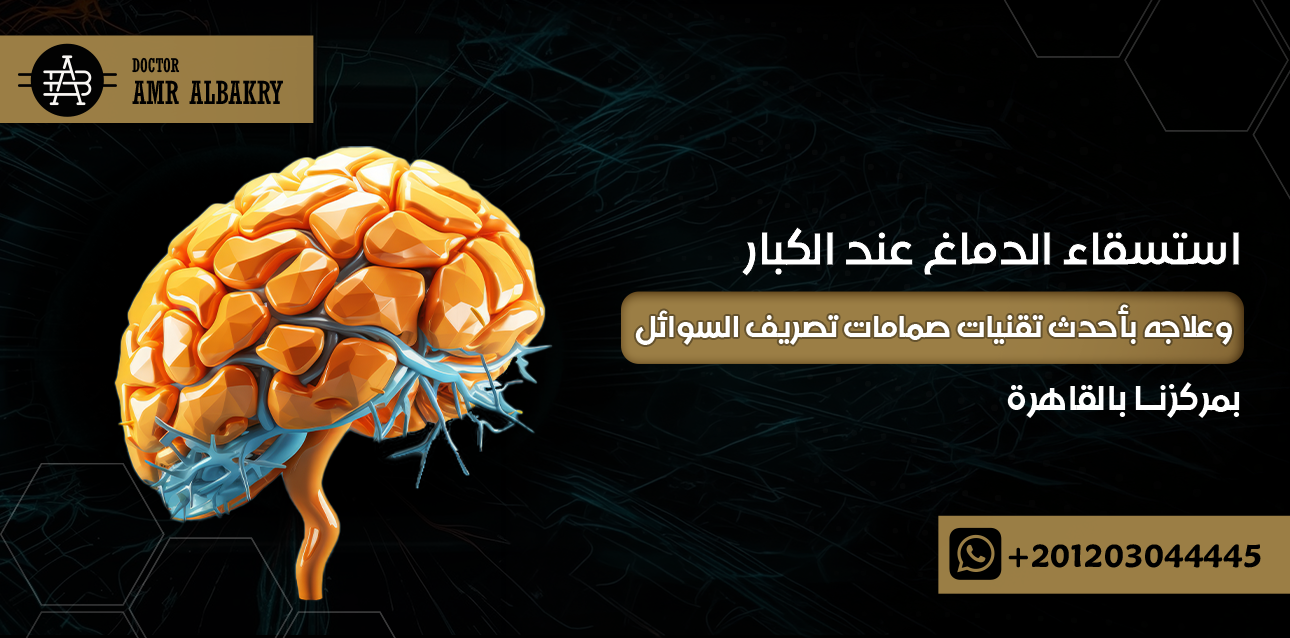 استسقاء الدماغ عند الكبار وعلاجه