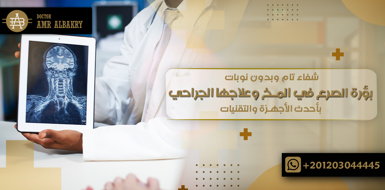 بؤرة الصرع في المخ وعلاجها الجراحي
